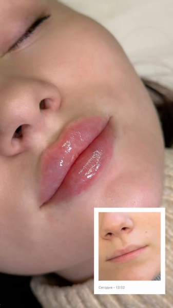  عکس مدل لب روسی قلوه ای
