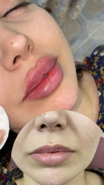  انواع مدل ژل لب با عکس