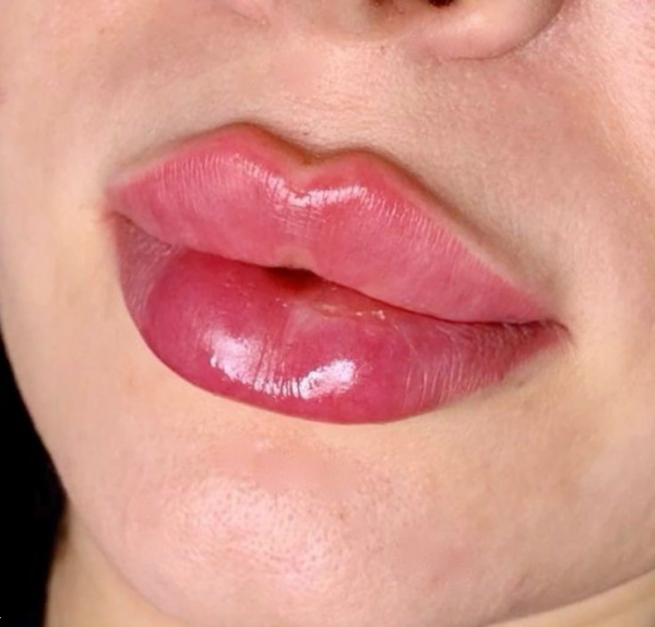  انواع مدل ژل لب با عکس