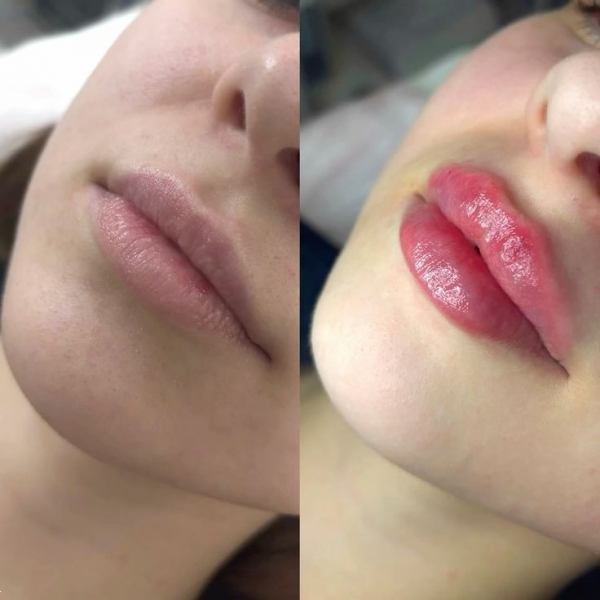  انواع مدل ژل لب با عکس