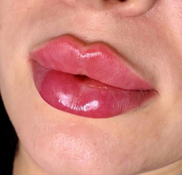  انواع مدل ژل لب با عکس
