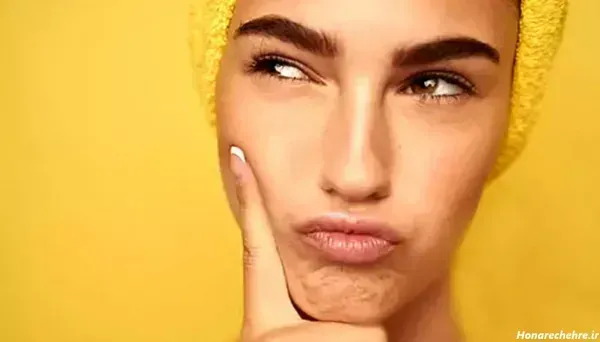  عکس فیشیال صورت قبل و بعد