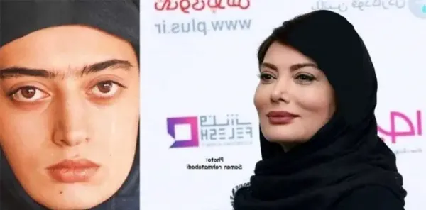  عکسهای قبل از عمل بازیگران زن ایرانی