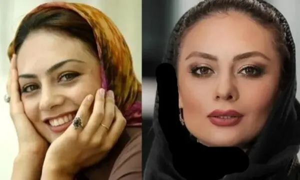  عکسهای قبل از عمل بازیگران زن ایرانی