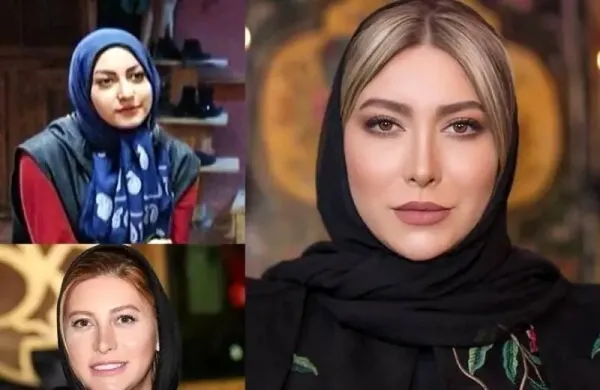  عکسهای قبل از عمل بازیگران زن ایرانی