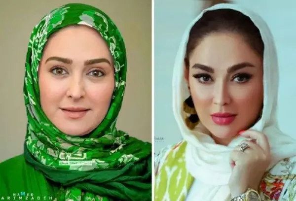  عکسهای قبل از عمل بازیگران زن ایرانی