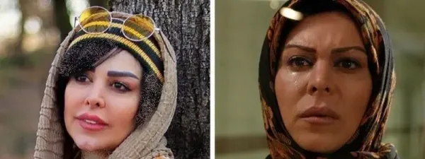  عکسهای قبل از عمل بازیگران زن ایرانی