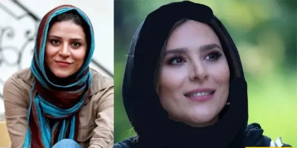  عکسهای قبل از عمل بازیگران زن ایرانی