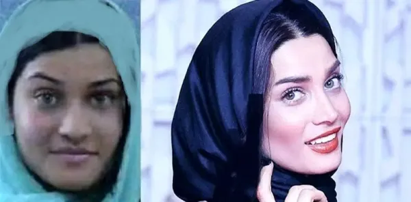 عکسهای قبل از عمل بازیگران زن ایرانی