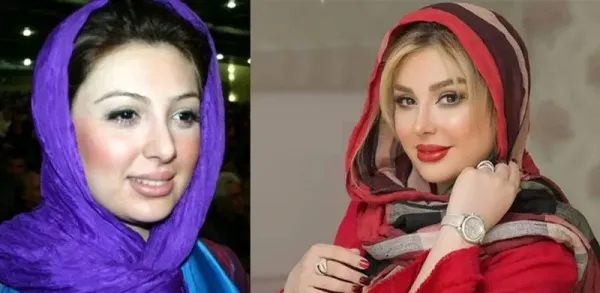  عکسهای قبل از عمل بازیگران زن ایرانی