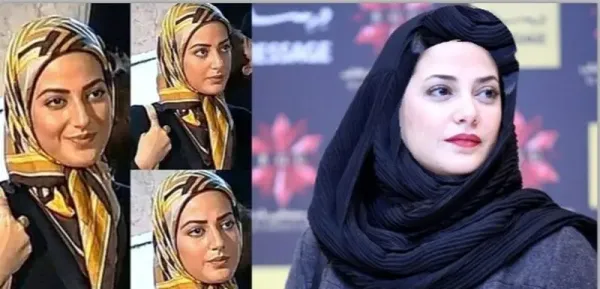  عکسهای قبل از عمل بازیگران زن ایرانی