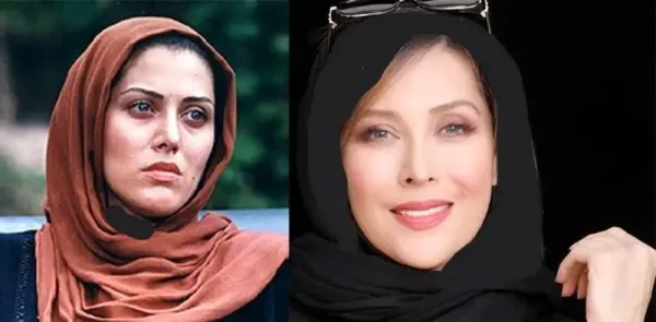  عکسهای قبل از عمل بازیگران زن ایرانی