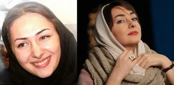  عکسهای قبل از عمل بازیگران زن ایرانی
