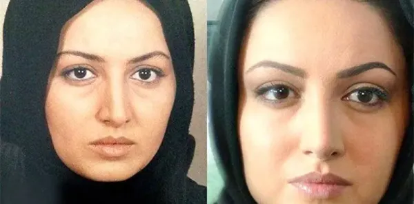  عکسهای قبل از عمل بازیگران زن ایرانی