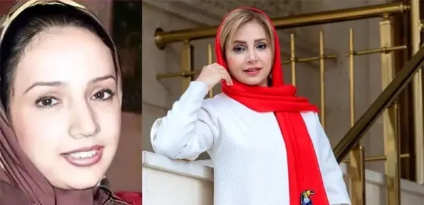  عکسهای قبل از عمل بازیگران زن ایرانی