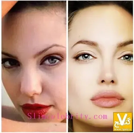  عمل های زیبایی آنجلینا جولی