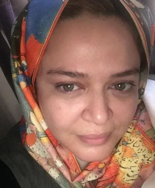  عکس دختر بدون آرایش خوشگل