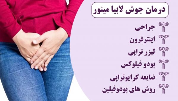 عکس جوش لبه داخلی واژن