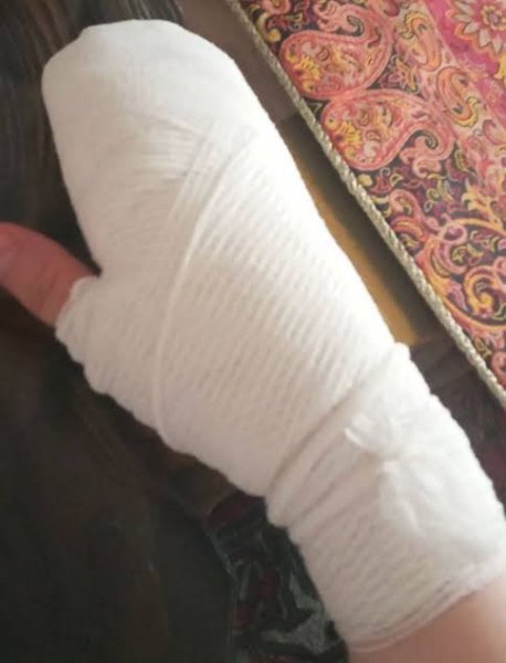  عکس دسته سوخته