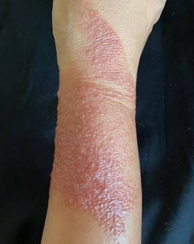  عکس دسته سوخته