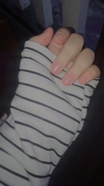  عکس دست دختر ۱۴ ساله