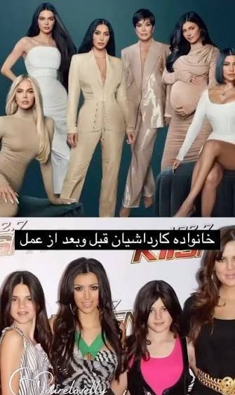 هیکل کیم کارداشیان قبل عمل