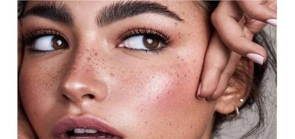  عکس زیبا زن با کک و مک و چهره‌ای جذاب