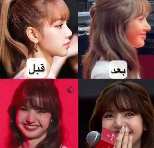  عکس لیسا بلک پینک قبل از عمل